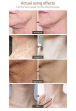Load image into Gallery viewer, LANBENA Hydrating Neck Cream Neck Mask Anti Wrinkle Firming Moisturizing  Health And Beauty Skin Care