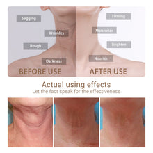 Load image into Gallery viewer, LANBENA Hydrating Neck Cream Neck Mask Anti Wrinkle Firming Moisturizing  Health And Beauty Skin Care